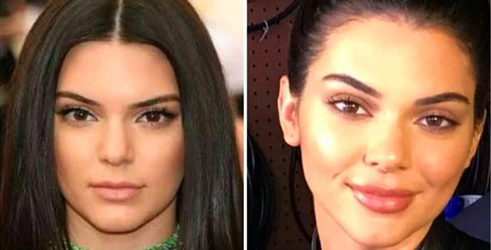 Бьюти-трансформация: Кендалл Дженнер увеличила губы?!