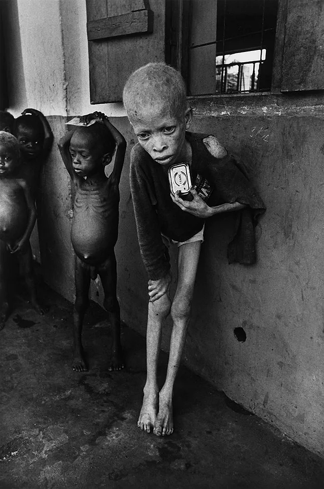 "Мальчик-альбинос", Биафра, Дон Маккалин, 1969