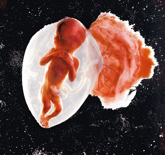 "Зародыш, 18 недель", Леннарт Нильсон, 1965.
