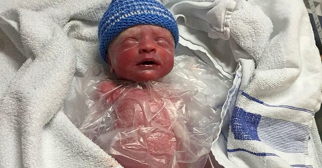 17. Doktorların 'Sandviç Poşeti'ne Sararak Kurtardığı Mucize Bebek Isaac ile Tanışın!