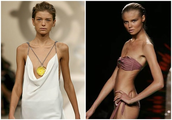 8. Начало нулевых: анорексия