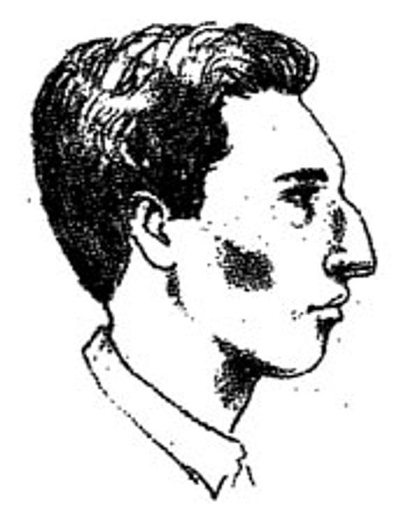 Выпуклый нос