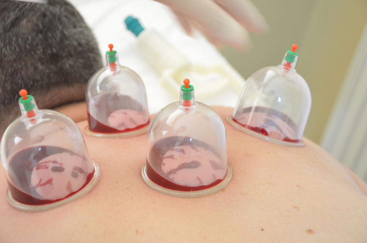 Her halükarda, iyice araştırma yapmadan yanaşmamanız gereken bir yöntem old...