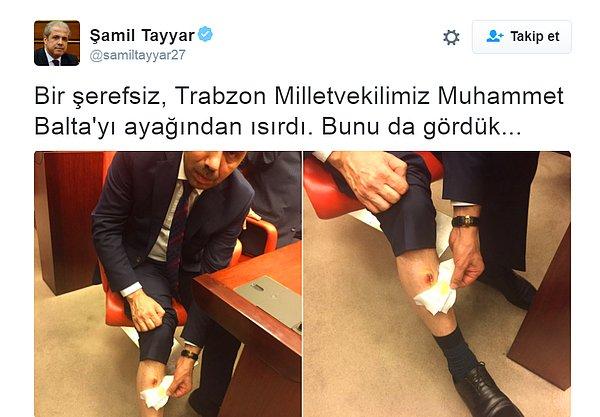 AKP Gaziantep Milletvekili Şamil Tayyar Twitter'da yaptığı paylaşımla bir vekil arkadaşlarının ısırıldığını iddia etti
