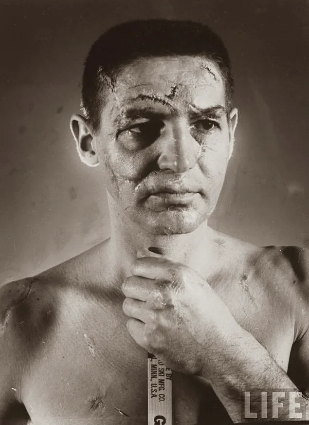 Terry Sawchuk - hockey goalie face when the mask was not yet mandatory attribute, 1966.