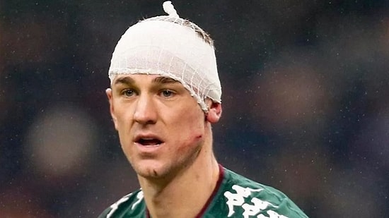 Yüzüne Aldığı Feci Krampon Darbesiyle Sakatlanan Joe Hart Kıl Payı Kurtardı