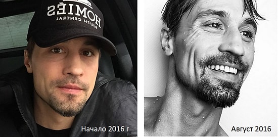 Дима Билан пугает поклонников своим болезненным видом!