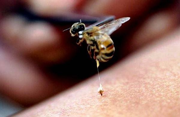 Araştırmacılar, bunun sebebinin arı sokmalarının ciddiye alınmaması olduğunu düşünüyor.