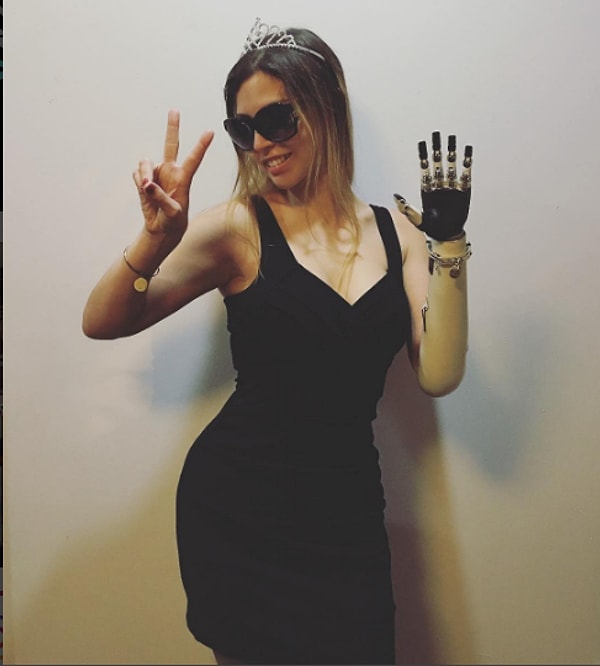 5. «Моя новая рука очень удобна, и она многое изменила, я могу пользоваться ею весь день, а на ночь поставить заряжаться, прямо как телефон», - сообщает Мишель.