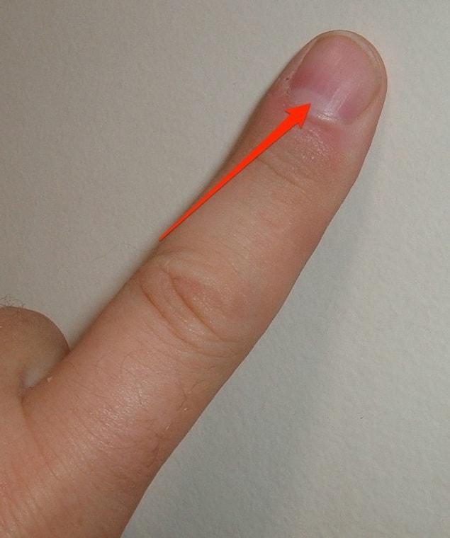 14. Lunula: the crescent-shaped whitish area of the bed of a fingernail or toenail.