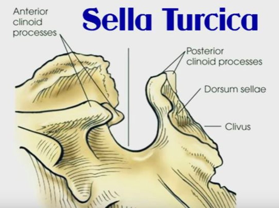 Турецкое седло. Dorsum sellae. Sella Turcica анатомия. Кливус анатомия. Клиновидная кость турецкое седло Sella Turcica.