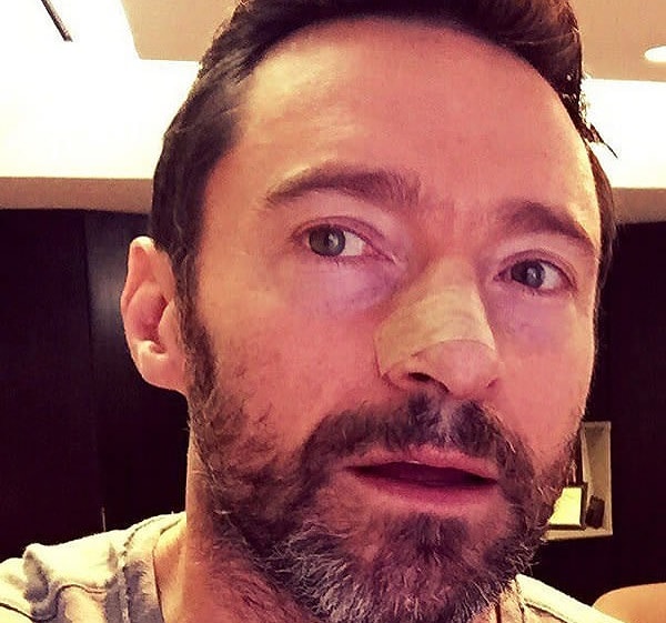 10. В 2016, после того, как удалили еще один рак, он предупредил своих поклонников о важности регулярного медицинского обследования