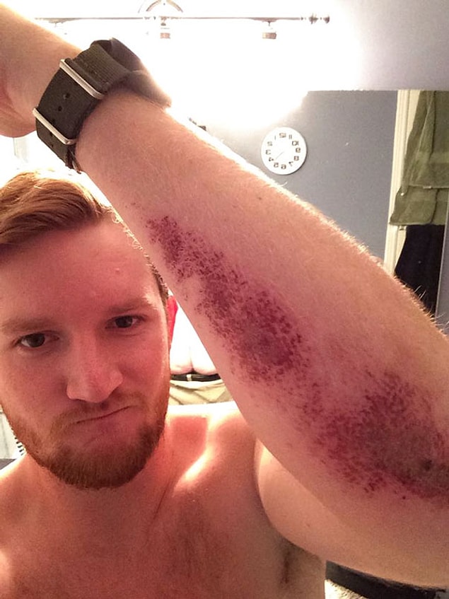 Look at my arm!
