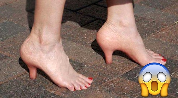 15 мерзких фото, которые будут сниться вам в кошмарных снах