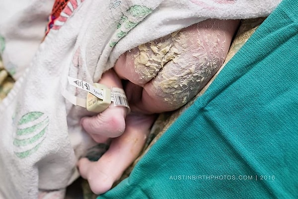 25. Первая защита