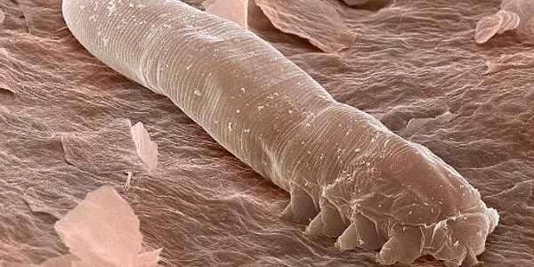 demodex no anus demodex no anus
