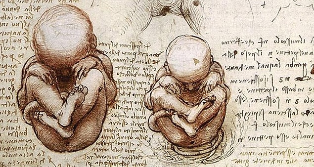 Woman Pregnant For 46 Years Gives Birth To Stone Baby Onedio Co