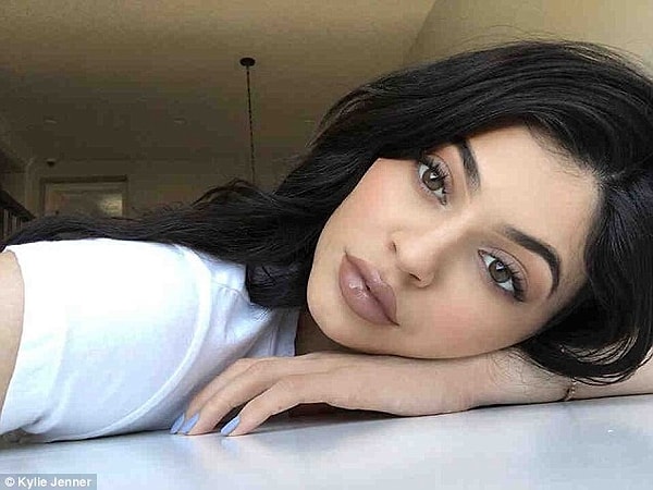 5. Перебор с филлерами в губах