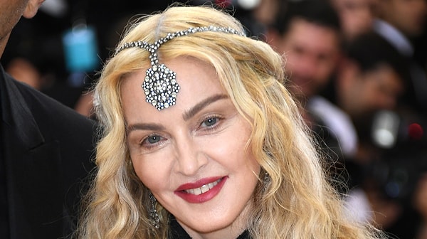 2. Скелетизация орбиты глаз, круги и синяки под глазами