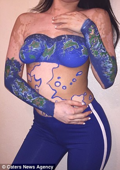 'I never realized how beautiful my vitiligo was until I traced it with a black marker,' she says.