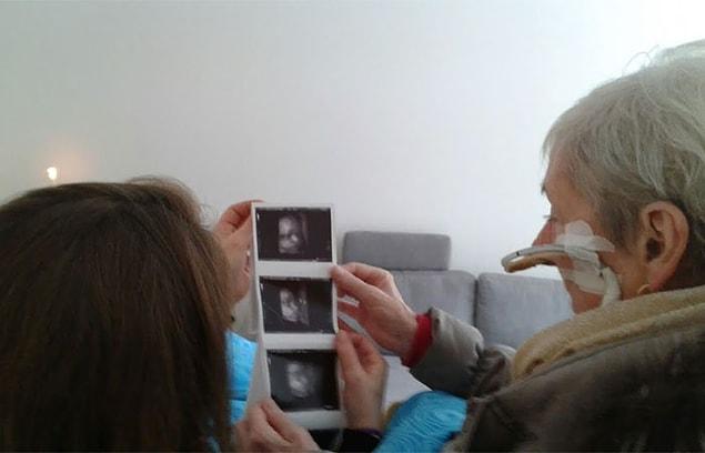26. One terminally ill woman's last wish was a visit to the hospital to see the scans of her unborn grandchild.