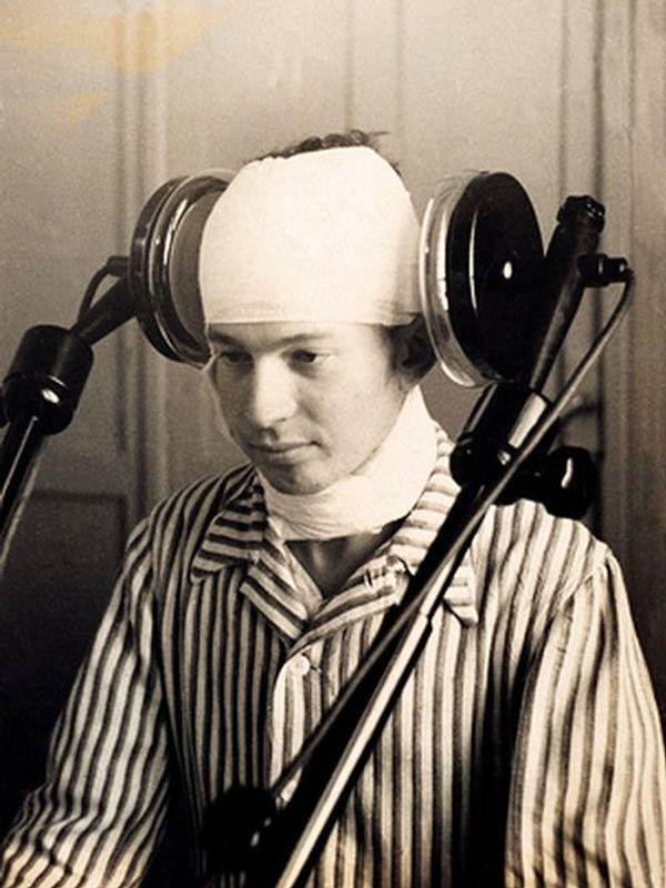 5. A patient undergoing lateral cerebral diathermia treatment in the early 1920's.  Diathermia used a galvanized current to jolt psychosis sufferers. Doctors eventually deemed it unsafe and unreliable.