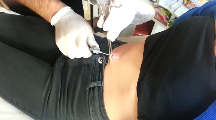 Göbek Piercingi Nasıl Yapılır?