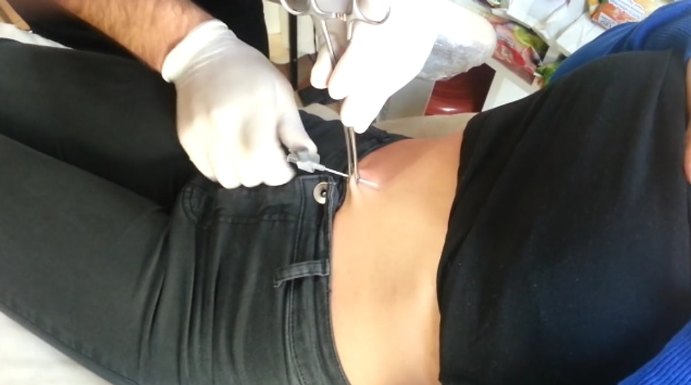 Göbek Piercingi Nasıl Yapılır?