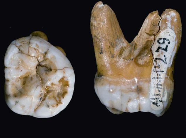8. A Denisovan’s tooth