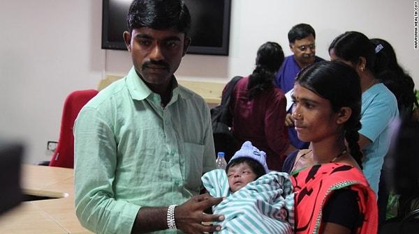 Geçtiğimiz Şubat ayında yine Hindistan'da bir çocuk 4 bacak ve 2 cinsel organla doğmuştu.