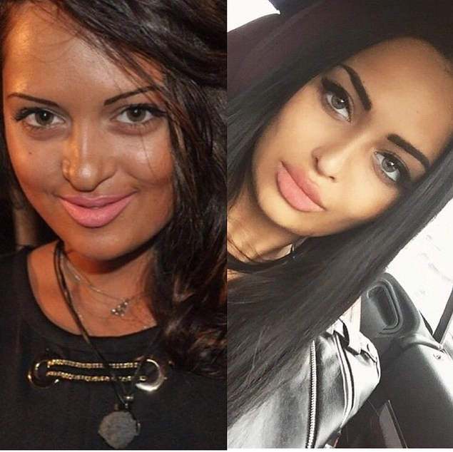 Everything Was A Lie 15 Pictures Of Instagram Celebrities Before Plastic Surgery Onedio Co