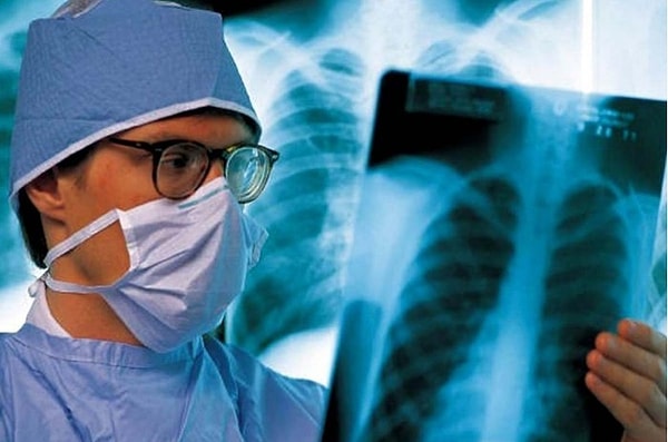 15. Туберкулёз