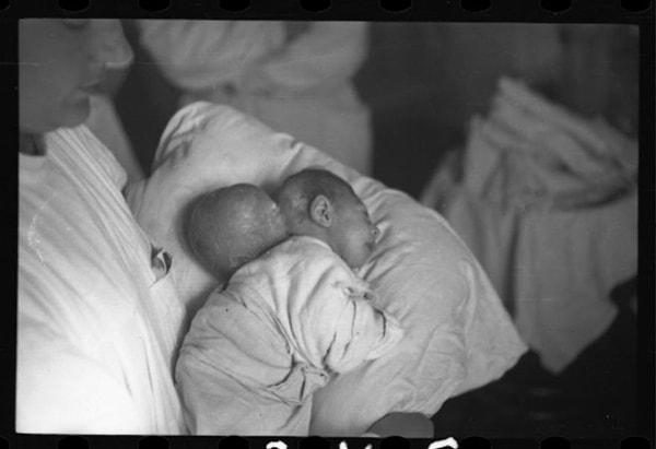 1940-1944, Ameliyat öncesi bebeği kucağında taşıyan hemşire