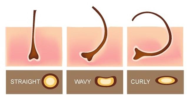 1. The hair shape is determined by the shape of the hair root. Curly hair comes out of the elliptical hair roots, while the straight hair comes out of the round roots.