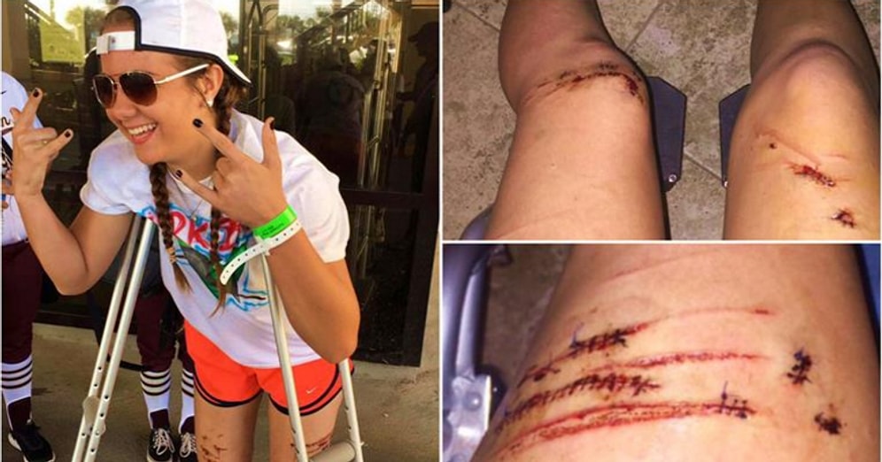 Köpek Balığının Burnuna Yumruk Atarak Saldırıdan Kurtulan 17 Yaşındaki Genç Kız