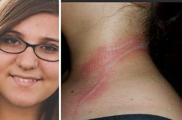 Jackie Fedro had been using her phone while it was plugged into a wall charger when she was shocked by an electric current that traveled from her phone to her necklace and singed her neck.