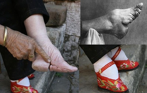 3. Бинтование ног в Китае