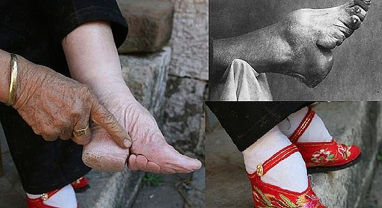 15 стандартов красоты из прошлого, которые могут ваc шокировать