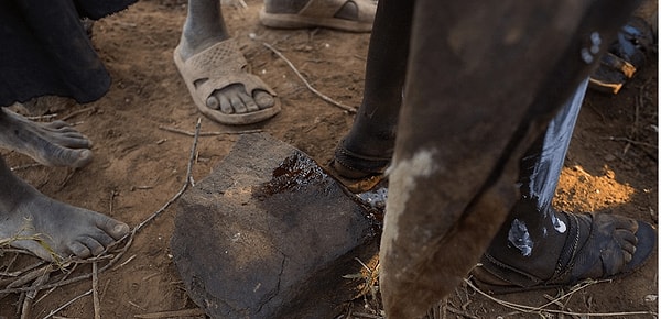 2. Так, в Африке и на Среднем Востоке до сих пор делают обрезание девочкам