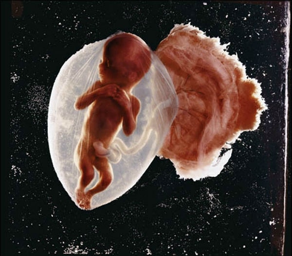 4. Первая фотография эмбриона (1965 год)
