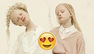 These Albino Twins Stunned The Internet With Their Utterly Unique Appearance!