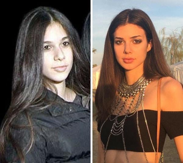 10. Defne Samyeli'nin 20 yaşındaki kızı Deren Talu'nun da yıllar önce birkaç estetik müdahale geçirdiği düşünülüyor.