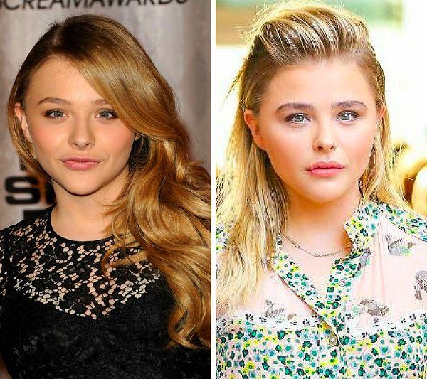 2. 20-year-old Chloë Grace Moretz has close encounters with the world of plastic surgery.