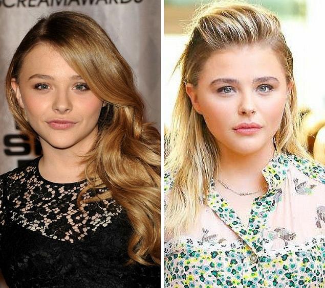 2. 20-year-old Chloë Grace Moretz has close encounters with the world of plastic surgery.