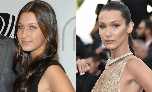 10 Celebrities Who Had Plastic Surgery Way Too Early In Life