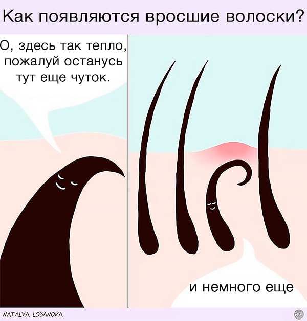 8. Ваши главные враги - вросшие волосы.