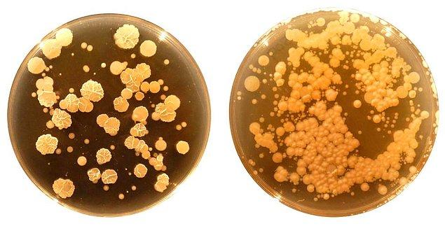 Sonuçlara göre göbek deliğimizde 1,458'i ilk kez bu çalışmayla gözlemlenen 2,368 bakteri türü bulunuyor.