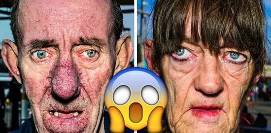 16 экстремально близких портретов людей, живущих на грани!