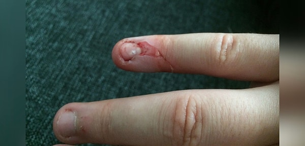 11. Нормально себя чувствуете? Вы почти завоевали звание главного пофигиста!