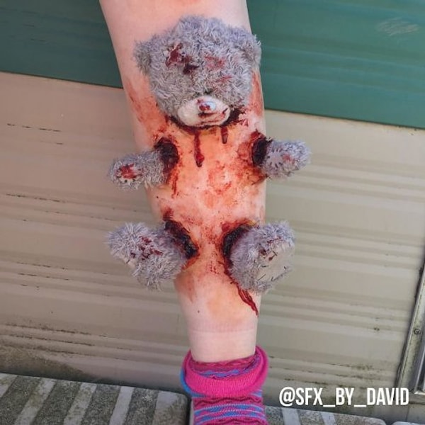 6. Тогда вот вам милый плюшевый мишка, застрявший в ноге Дэвида